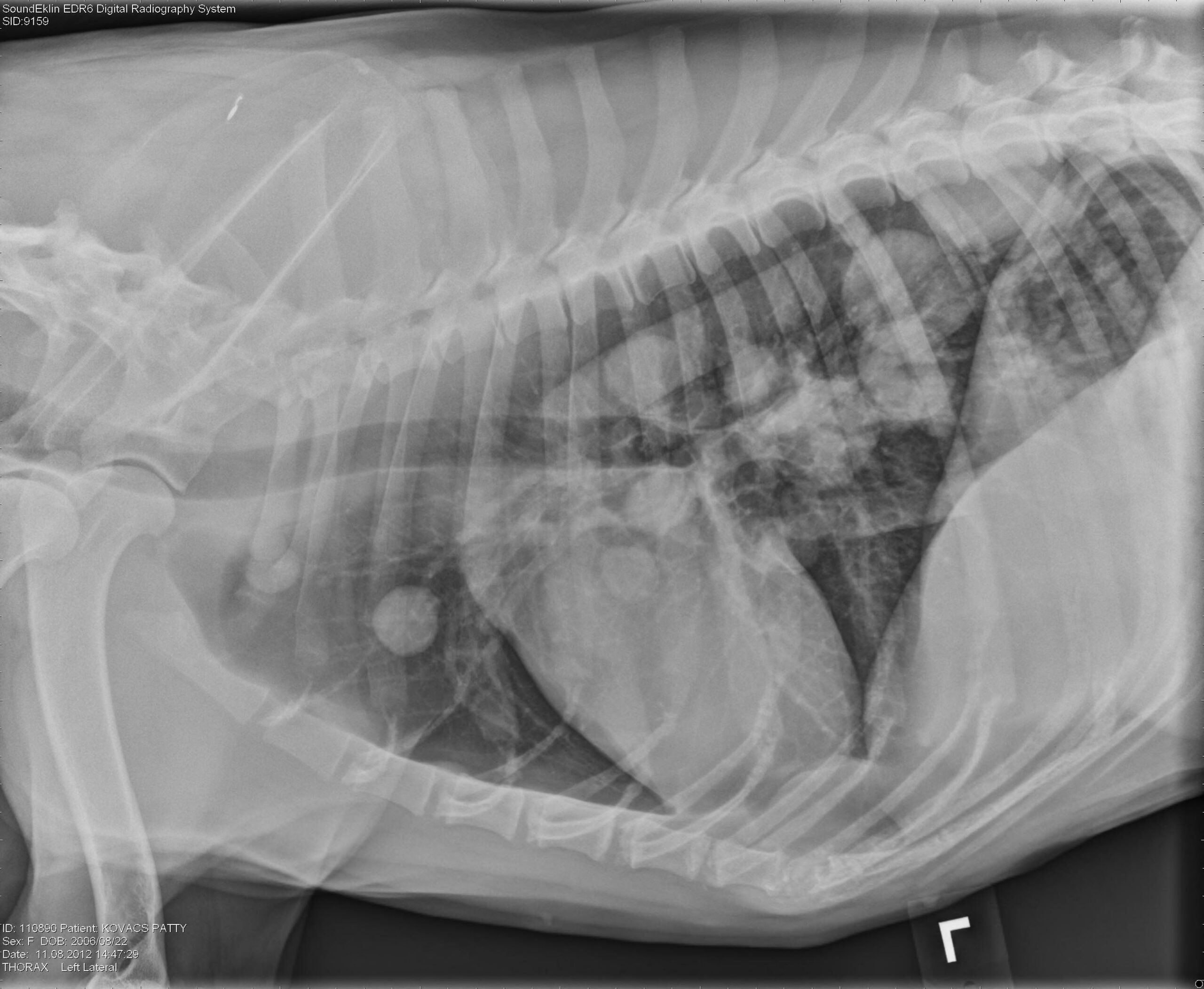 Lung Cancer