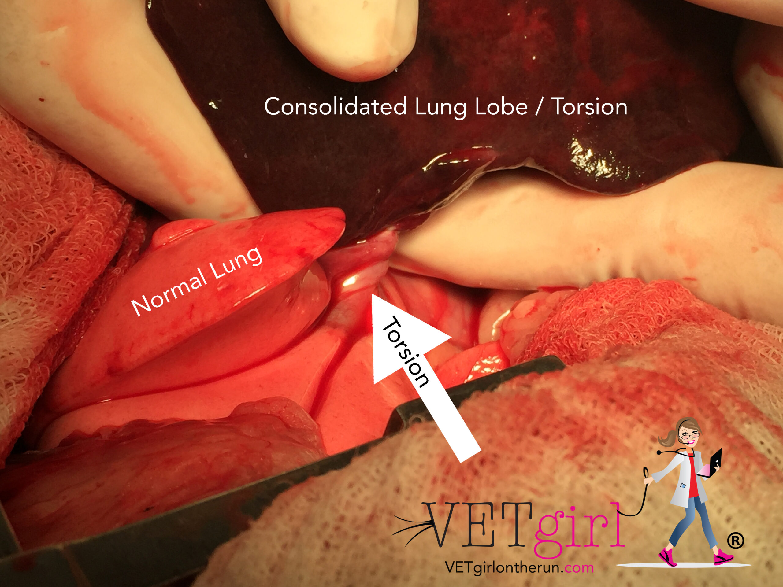 Lung lobe torsion surgery in a dog