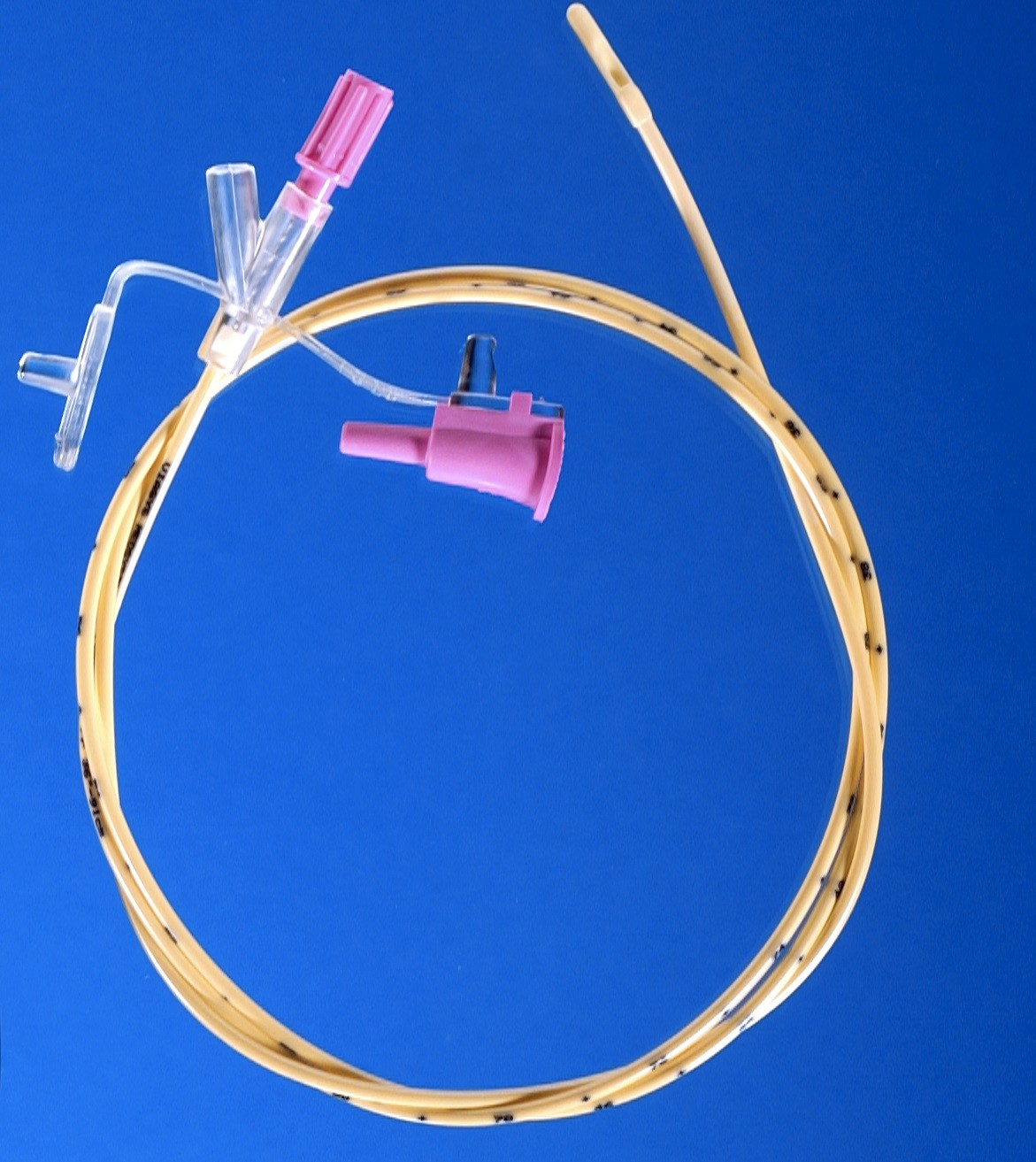 MILA NG NE feeding tube
