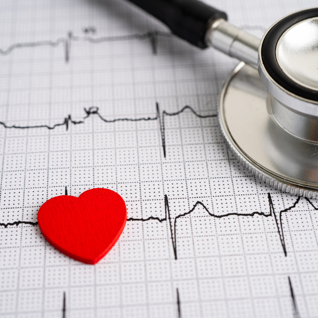 Close up of ECG with stethoscope bell and heart image from canva