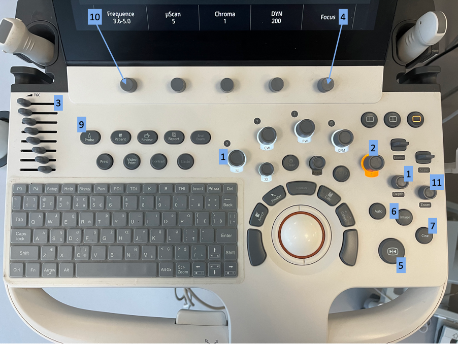 An image of the Ultrasound keyboard with all knobs and buttons labeled with a number that corresponds to the blog.